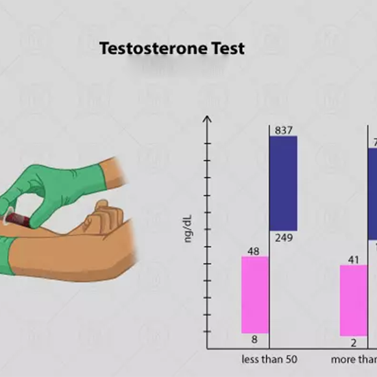 Free Testostrone